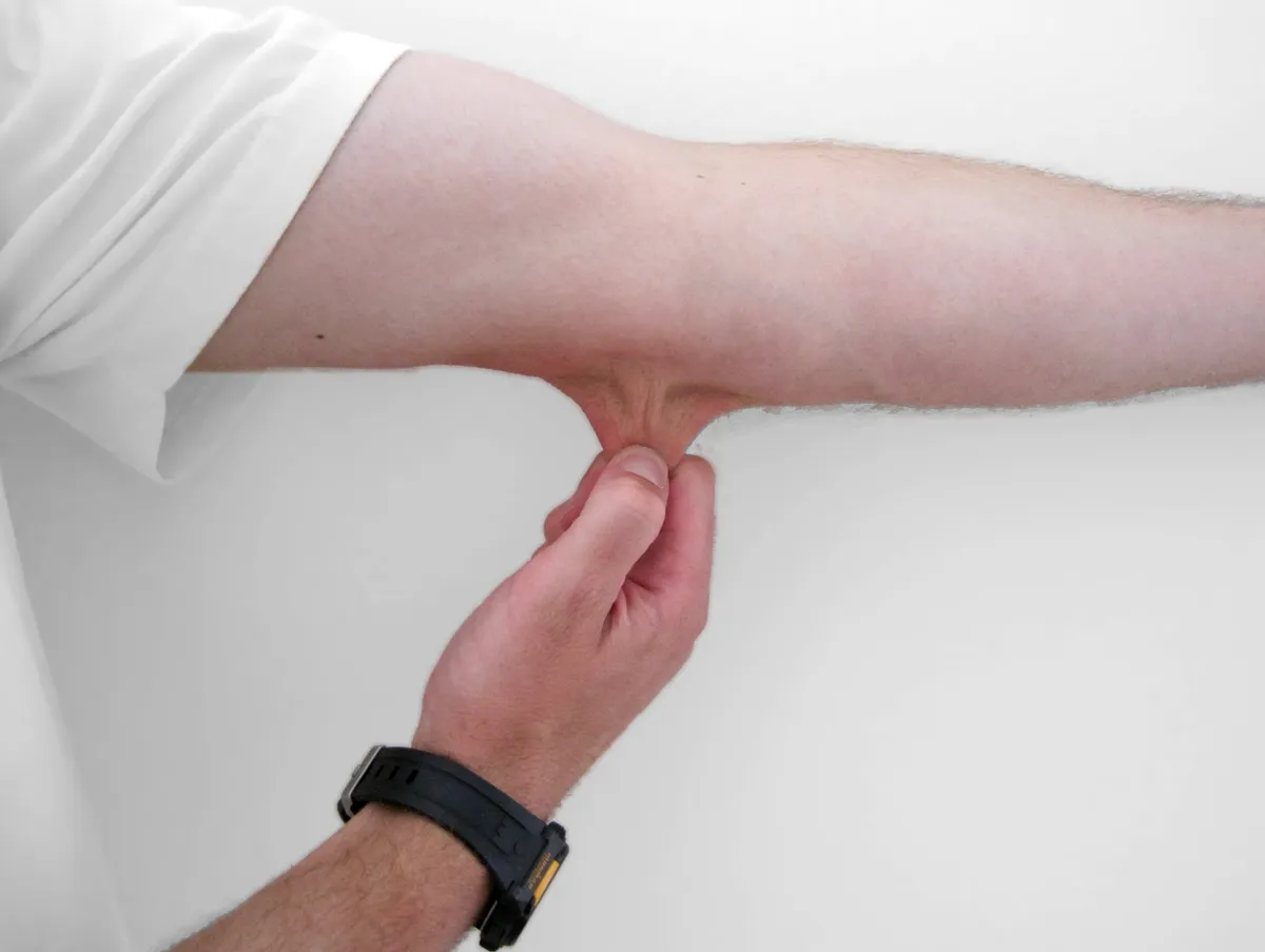 Close-up of skin texture, illustrative image