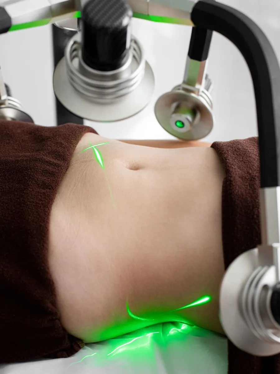 Non-invasive body contouring treatment session, illustrative image