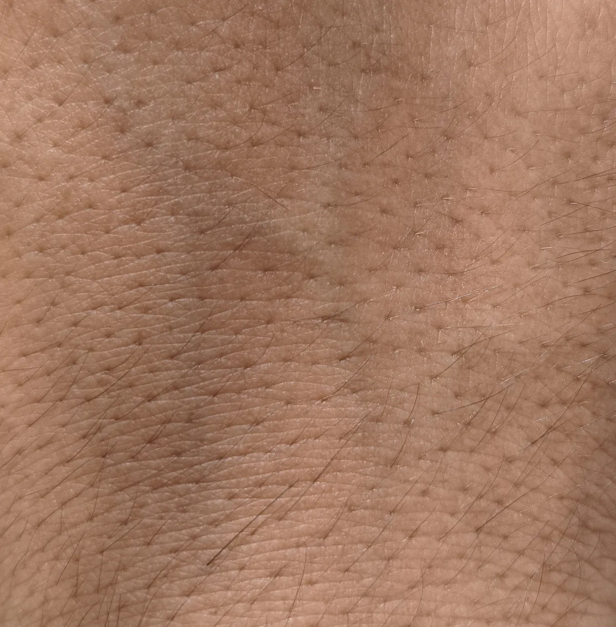 Close-up of skin texture, illustrative image
