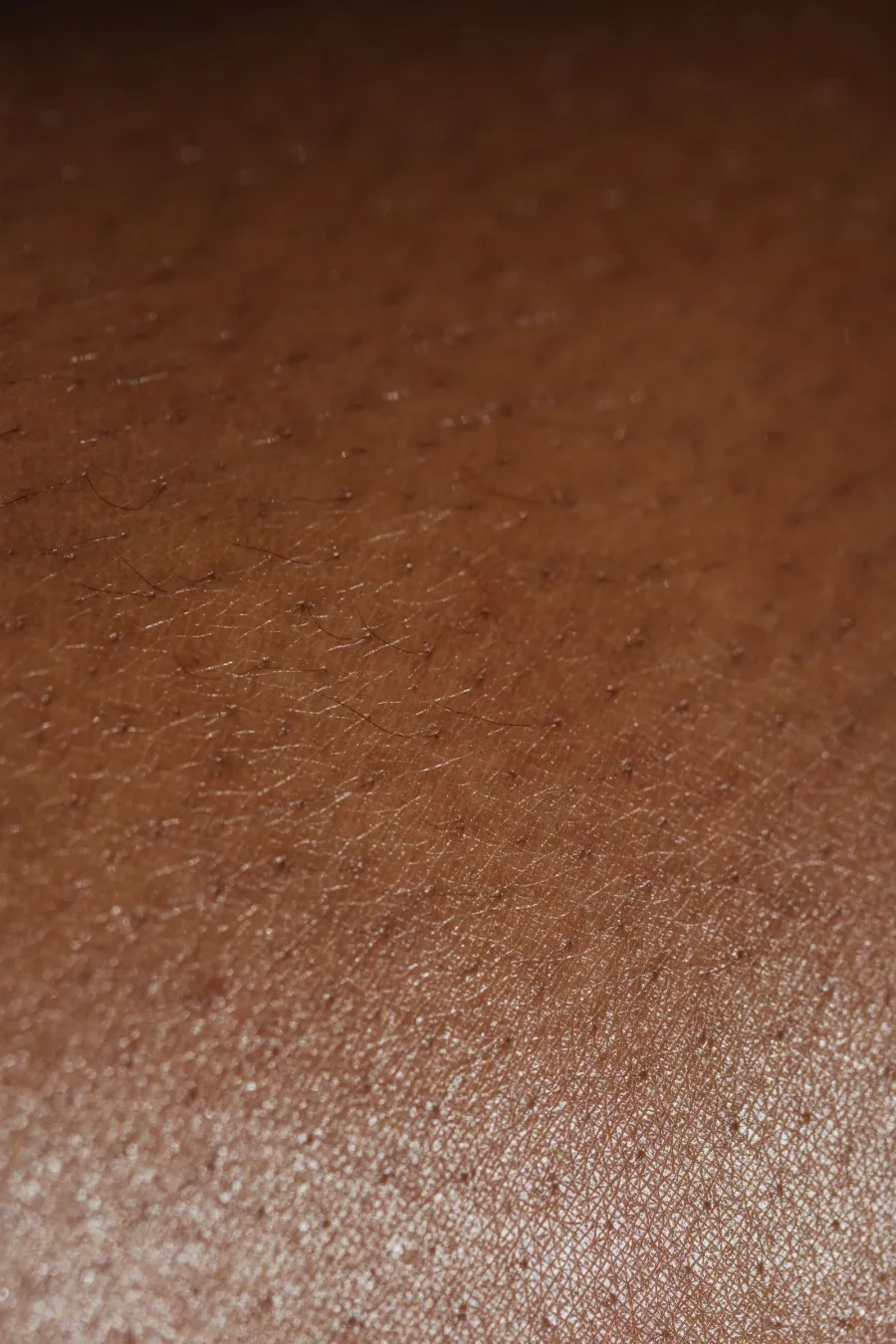 Close-up of skin texture, illustrative image