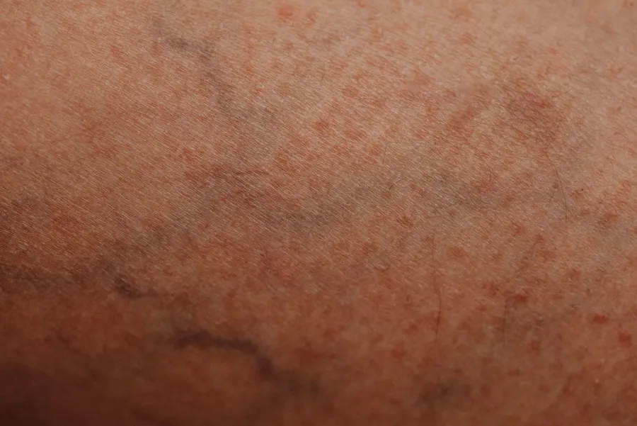 Close-up of skin showing natural texture and vein patterns