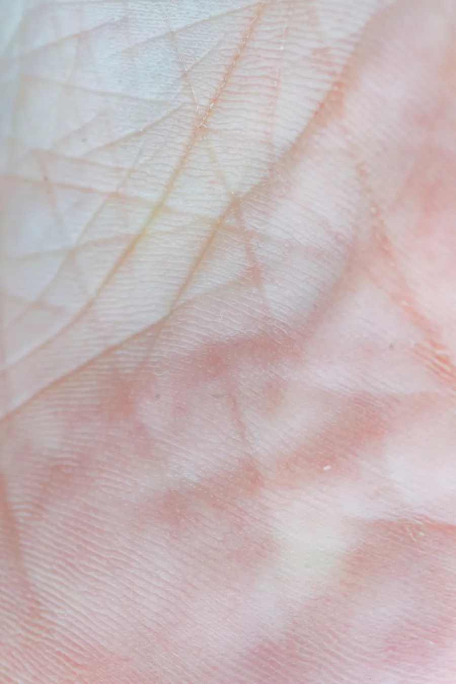 Close-up of natural skin surface and texture