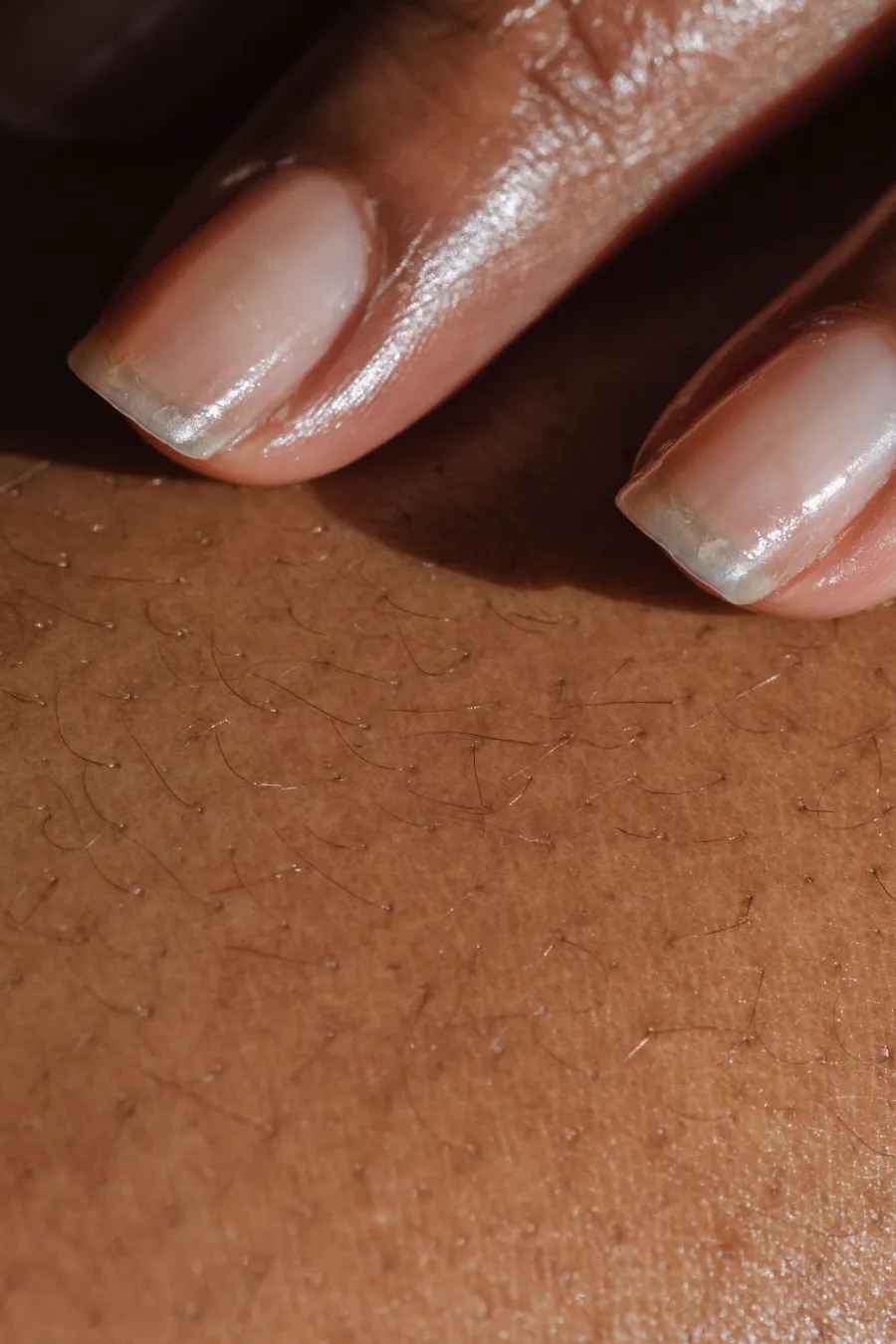 Close-up of fingers and skin texture, illustrative image