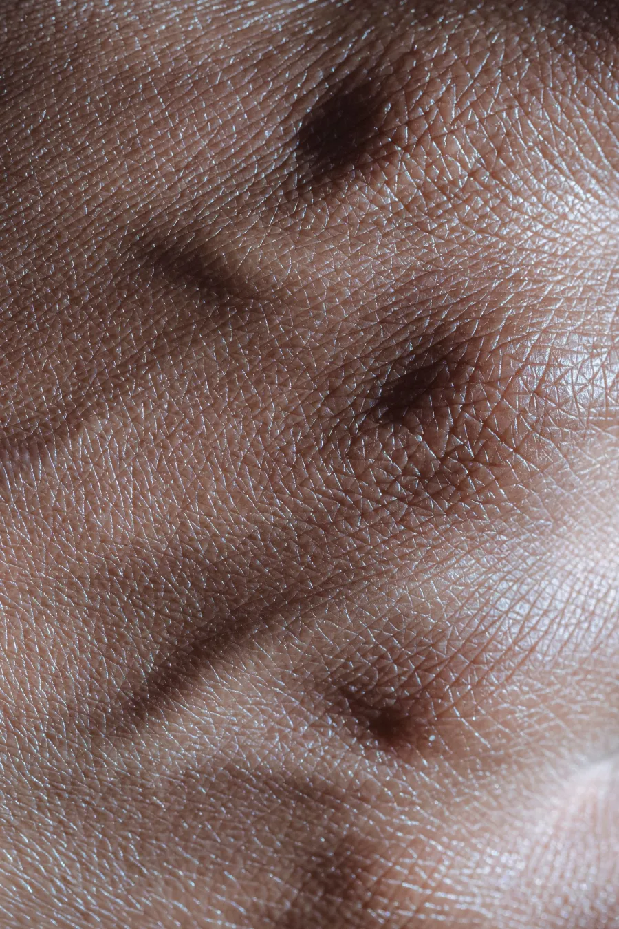Close-up of skin texture, illustrative image