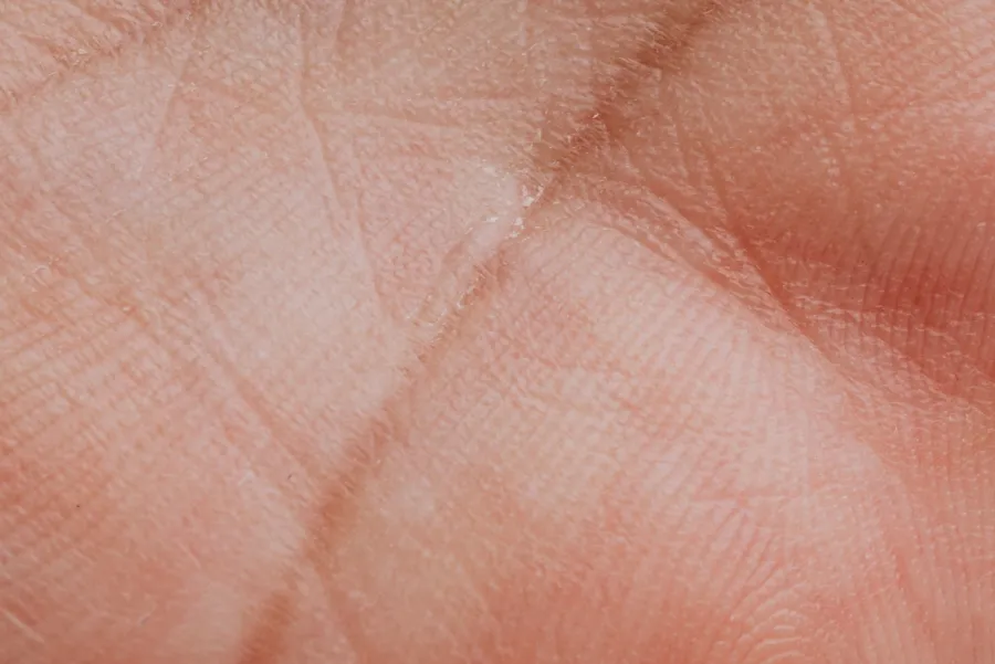Close-up of hand skin showing natural lines and texture