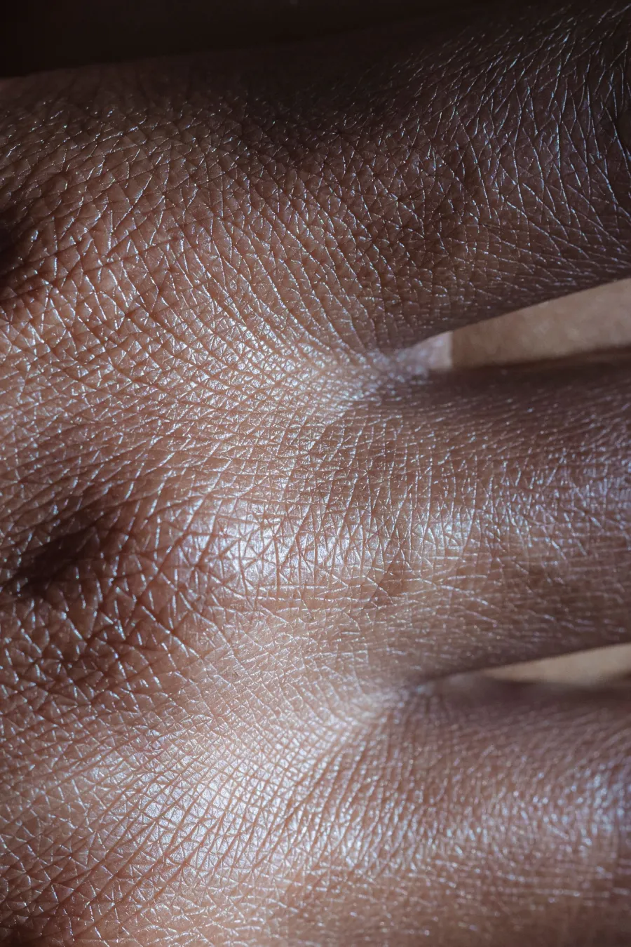 Close-up of skin texture, illustrative image