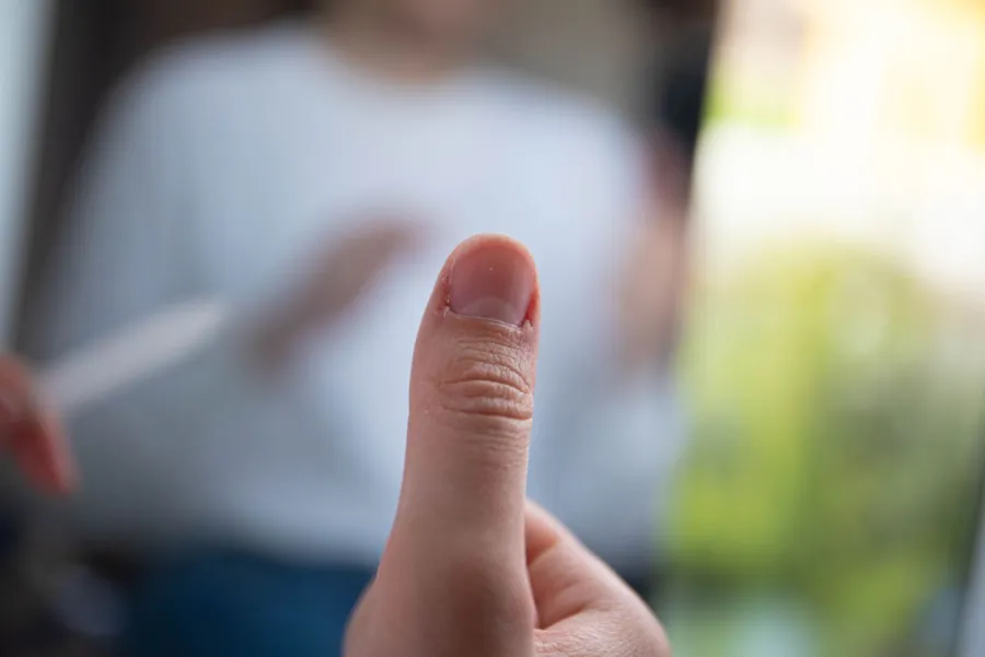 Close-up of hand and finger skin, illustrative image
