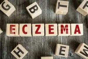 a graphic that spells eczema in blocks