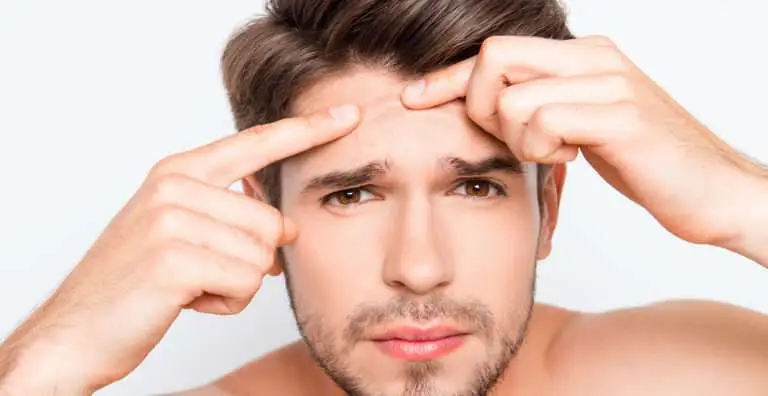 Young man squeezing a pimple on his forehead.
