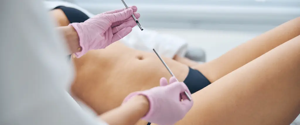 Medical professional in gloves holding surgical tools over a patient's abdomen, preparing for a dermatological procedure.