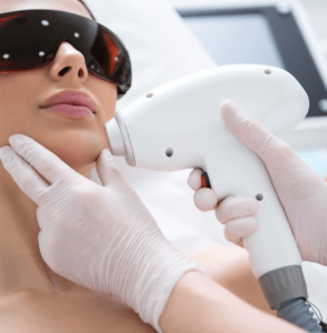 Woman receiving laser treatment on face with protective eyewear, performed by a professional with a handheld device.