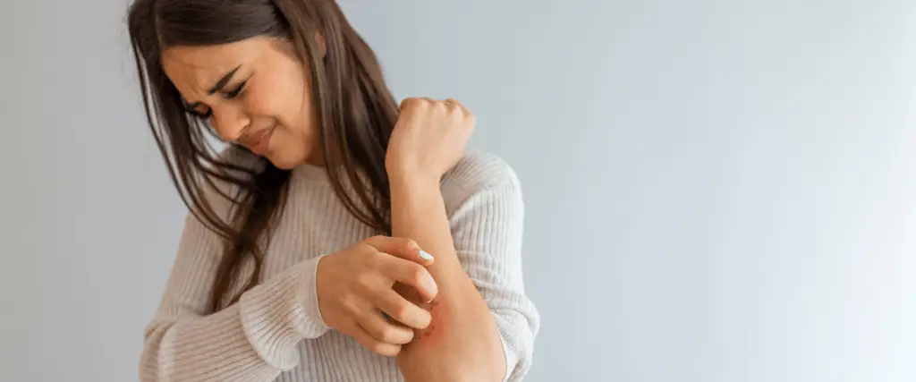 Woman scratching her arm, showing signs of discomfort or skin irritation