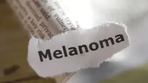 Close-up of torn paper strip showing the printed word “Melanoma.”
