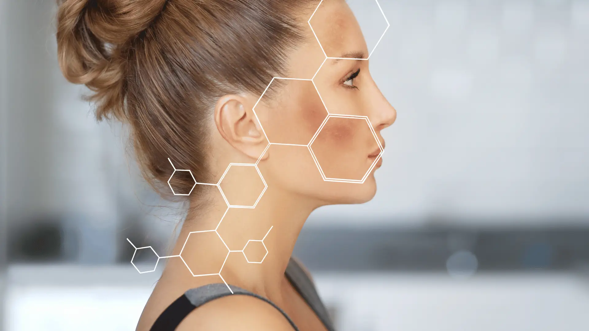 Sun marks | Dermatology of seattle