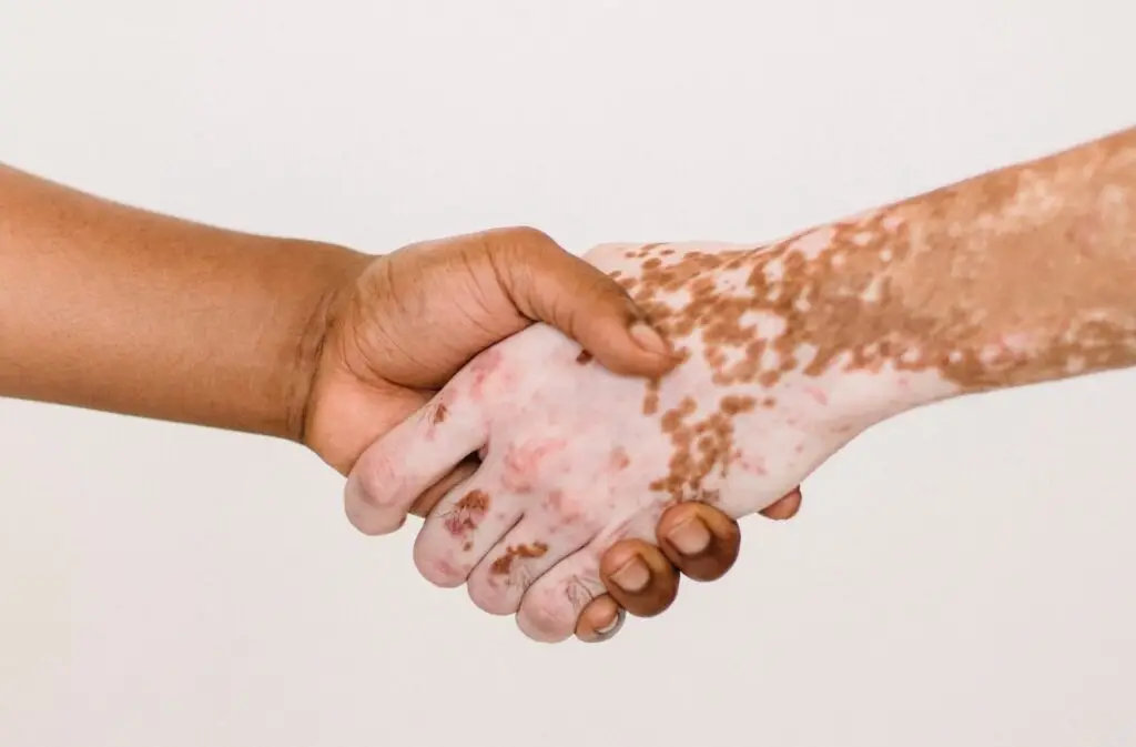 An image of two hands with different skin types that are hand-shaking