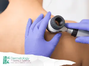 Dermatologist examining patient’s upper back mole with dermatoscope and gloves