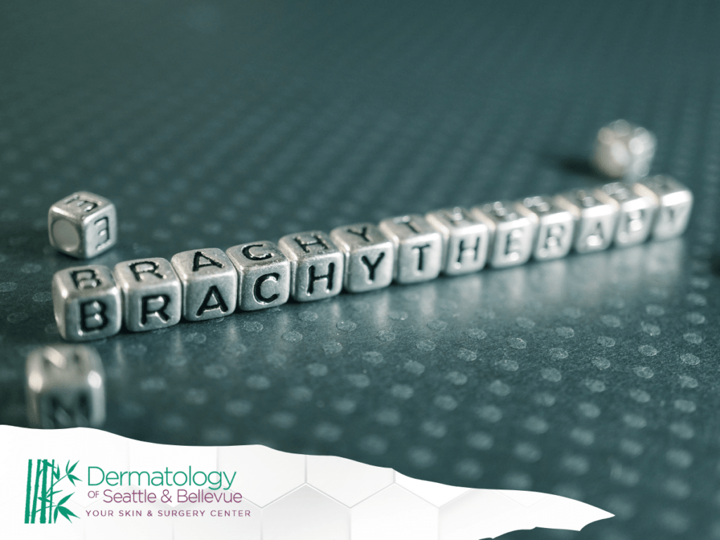 Close-up of letter blocks spelling 'BRACHYTHERAPY' on a textured surface, with the Dermatology of Seattle & Bellevue logo in the corner.