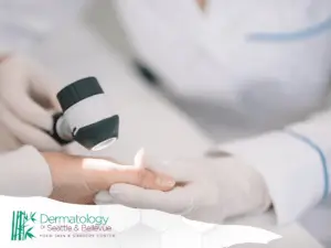 Dermatologist examining a patient's hand with a dermatoscope, with the Dermatology of Seattle & Bellevue logo in the corner.