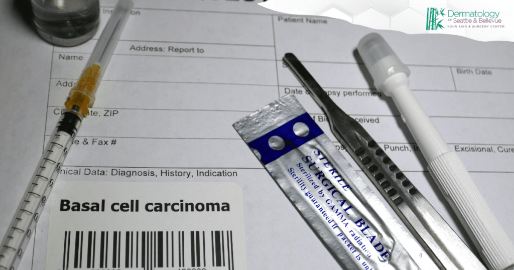 Medical tools and a diagnosis form for basal cell carcinoma, with a syringe, surgical blade, and biopsy tool, and the Dermatology of Seattle & Bellevue logo in the corner.