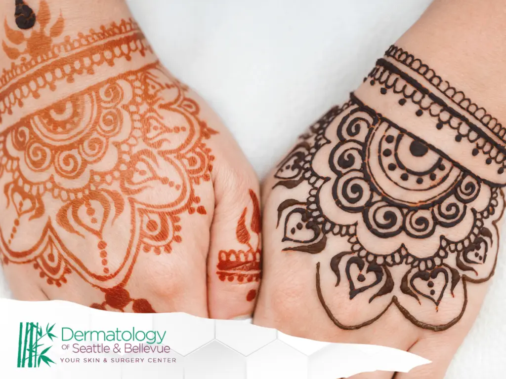 Two hands decorated with intricate henna designs in dark brown and red.