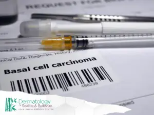 Close-up of medical documents and syringes with a label indicating 'Basal cell carcinoma,' highlighting dermatological diagnosis.
