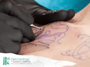 Professional tattooing process on the chest area, showcasing intricate design and sterile equipment.