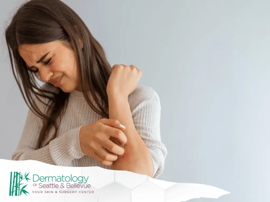 Woman scratching red, irritated patch on her forearm.