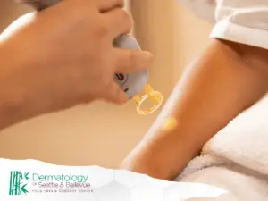 Close-up of a specialized device being used for a light-based skin treatment on a person's arm.