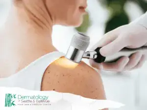 Dermatologist using a dermatoscope to examine a patient's shoulder for skin evaluation.