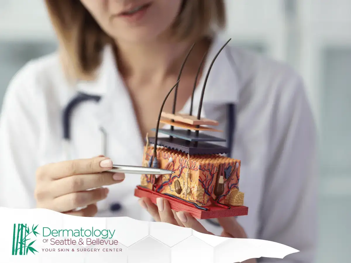 Doctor holding anatomical skin model with tweezers in clinic.