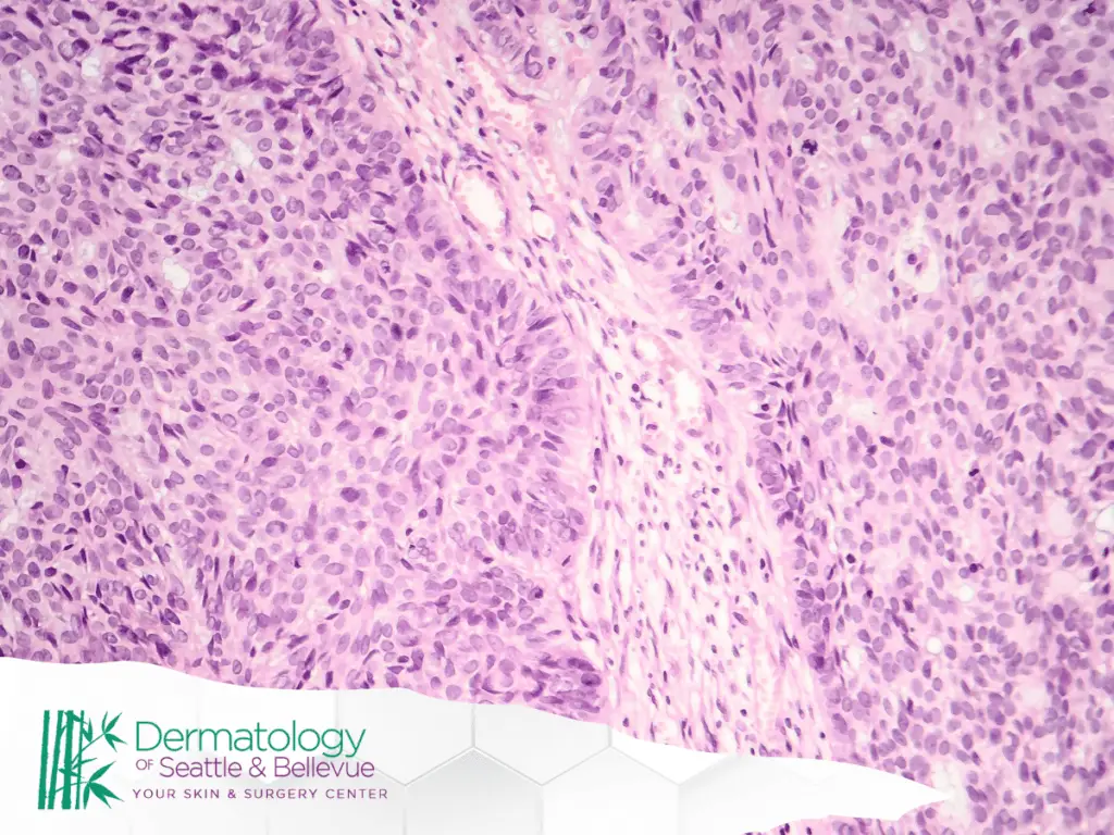 Microscopic view of pink and purple stained tissue cells pattern