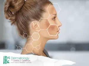 Profile of woman with facial discoloration and overlaying hexagon graphics