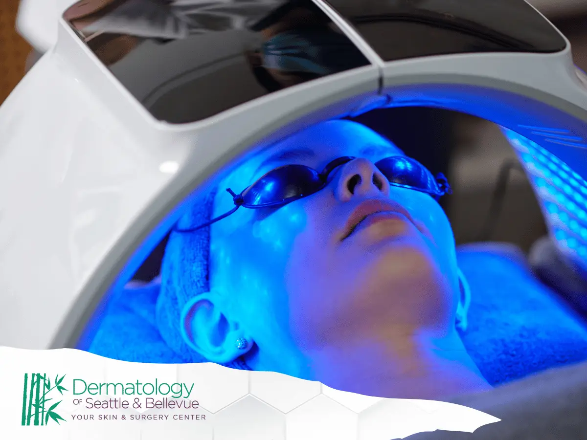 Person lying under blue LED light therapy device wearing eye shields