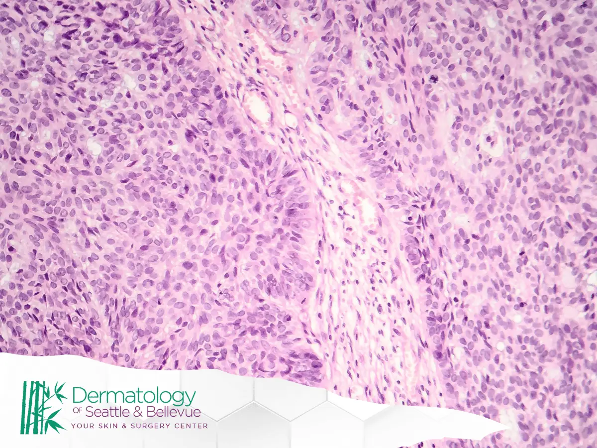 Microscopic view of pink and purple stained tissue cells pattern