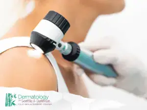 Gloved hand using dermatoscope to examine mole on shoulder
