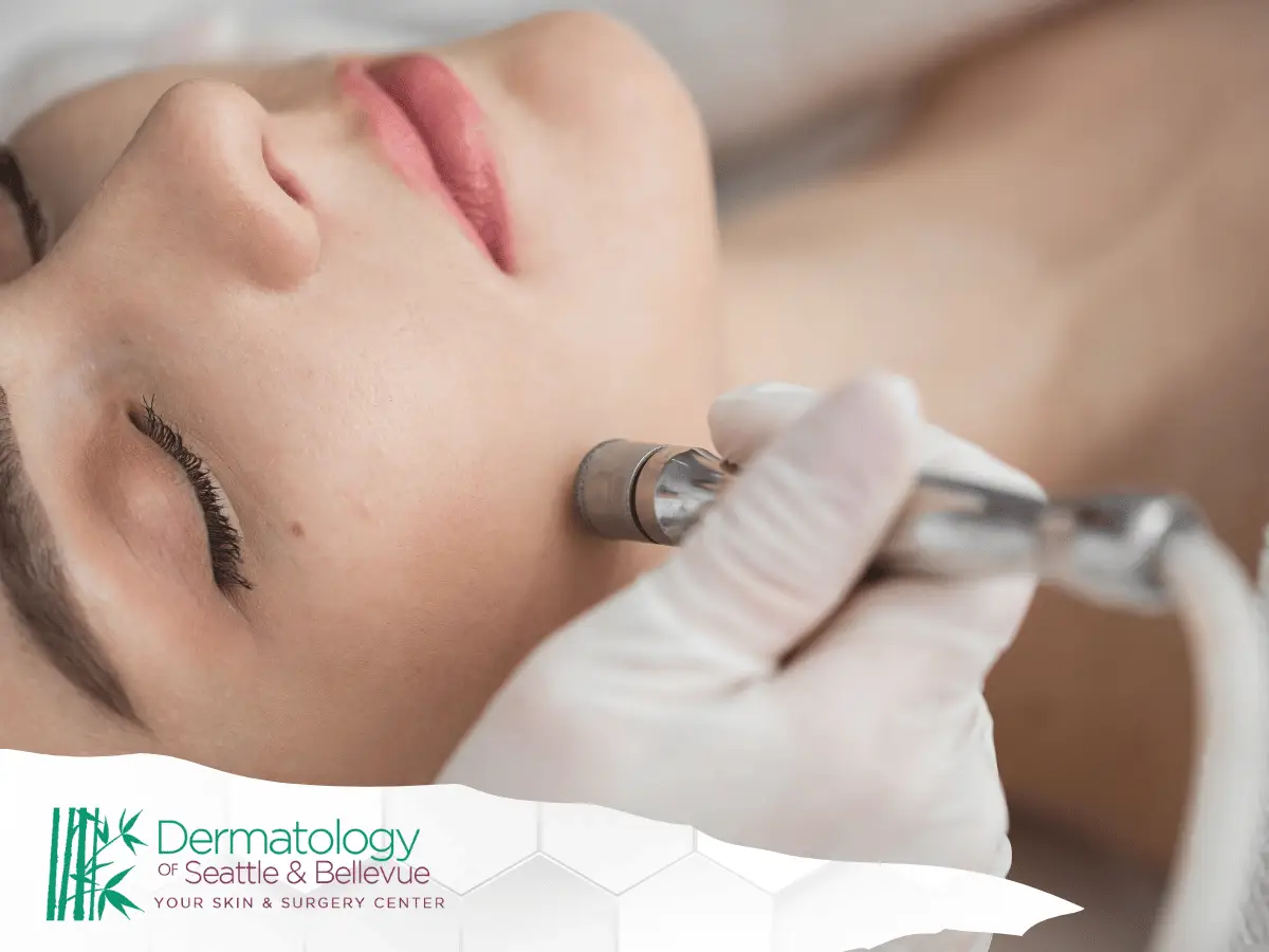 Close-up of gloved hands performing facial skin treatment on woman.