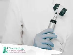 Gloved hand holding a dermatoscope against white medical coat