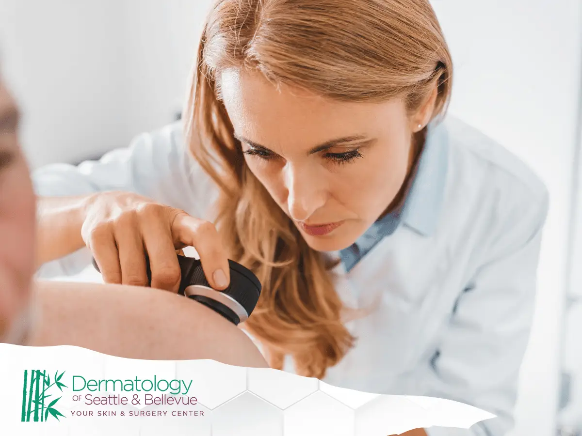 Female dermatologist examining a patient’s skin with a dermatoscope.