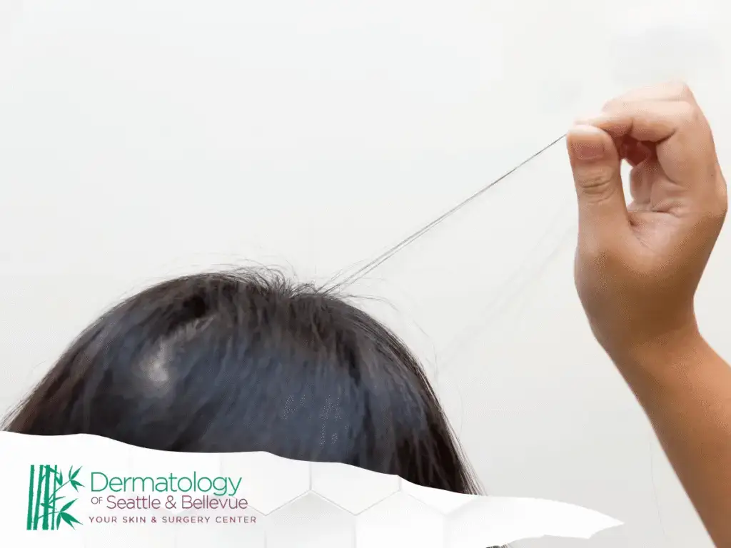 Hand pulling a few strands of hair from scalp.