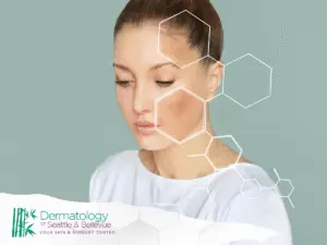 Woman with facial discoloration overlaid by white hexagon graphics.