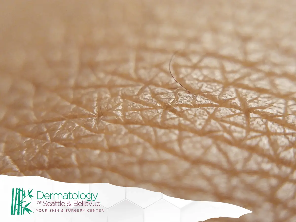 Extreme close-up of textured human skin with a single hair.
