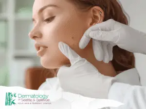 Dermatologist in white gloves examining mole on woman’s cheek