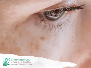 Close-up of an eye with light brown facial freckles.