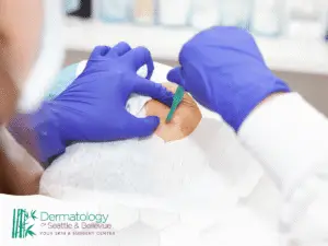 Gloved hands performing minor skin procedure on patient’s back