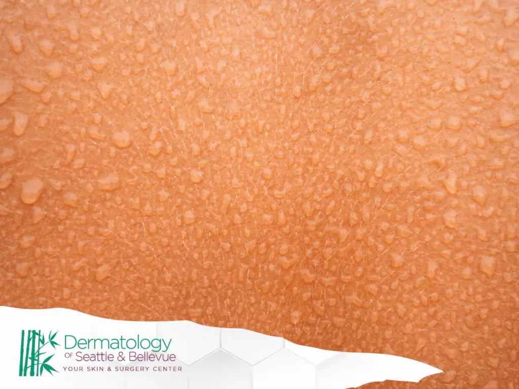 Close-up of moist, textured orange skin with water droplets.