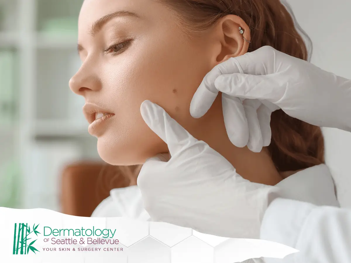 Dermatologist in white gloves examining mole on woman’s cheek