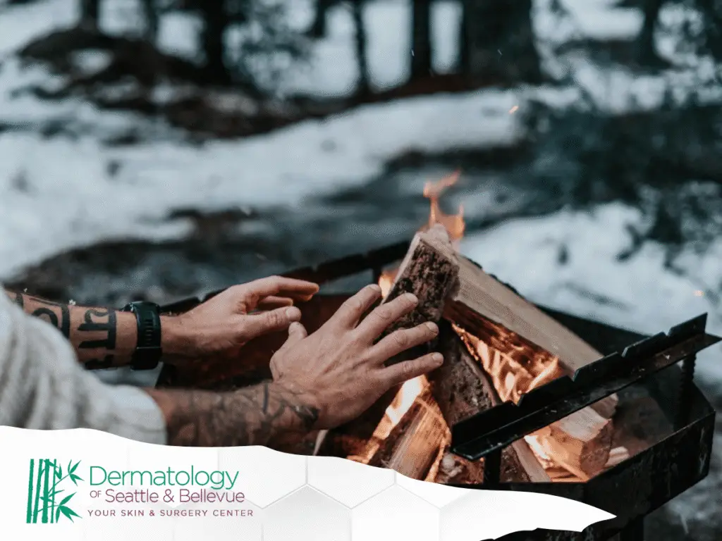 Tattooed hands warming near a campfire in snowy forest.