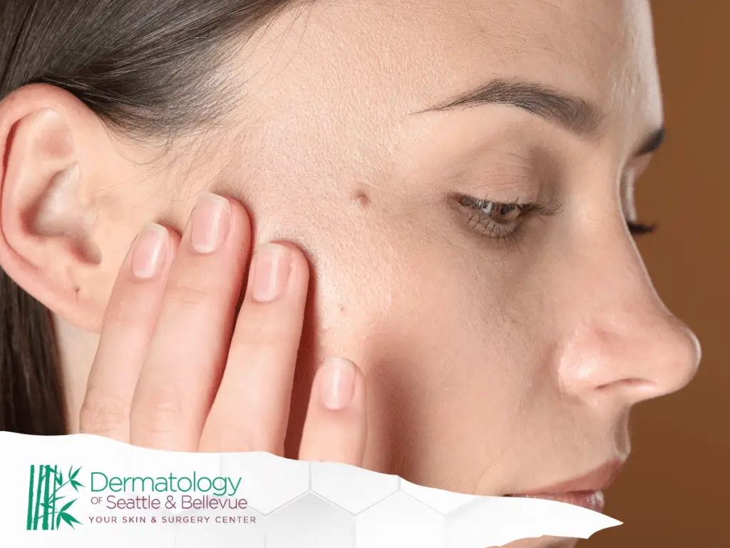 Close-up of woman touching small mole on her cheek.