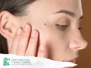 Close-up of woman touching small mole on her cheek.
