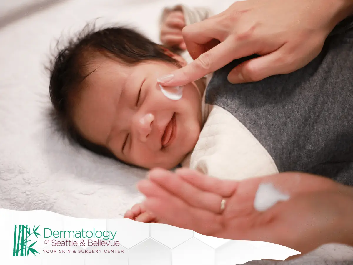 Smiling baby lying down while adult applies cream to cheek
